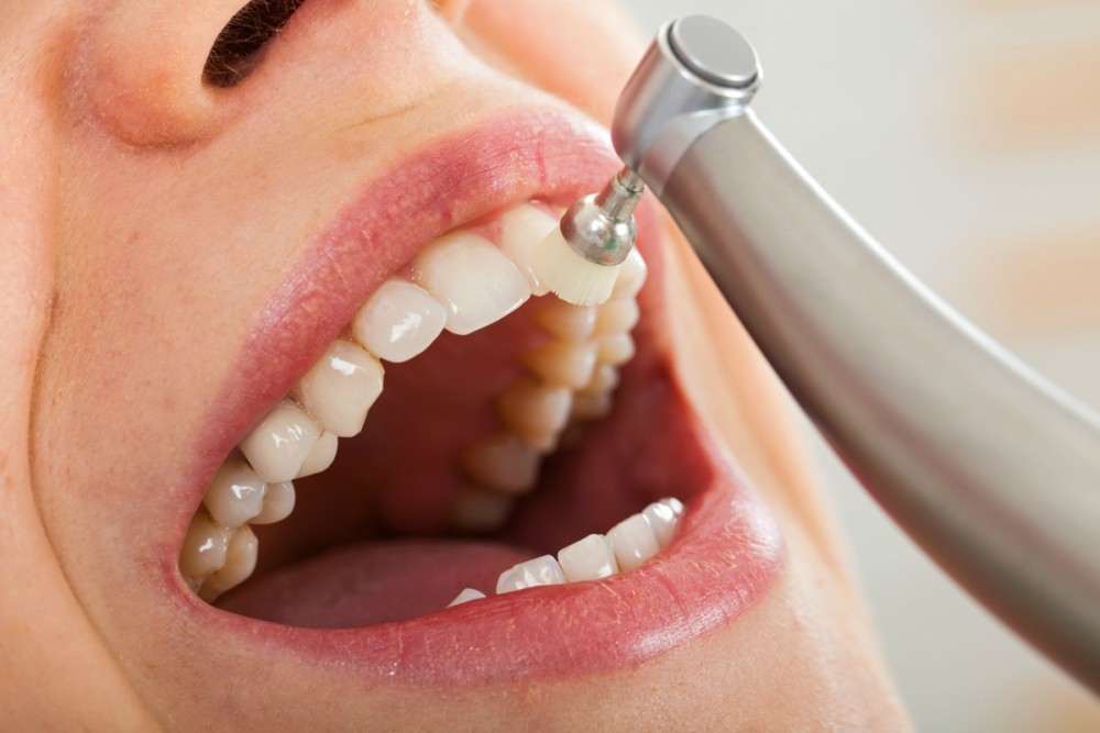 ¿Cuánto cobra un protésico dental? Sal de dudas ahora