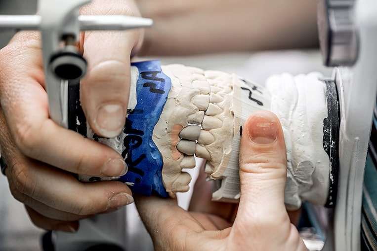 Sueldo del protesista dental: ¿Cuánto gana?